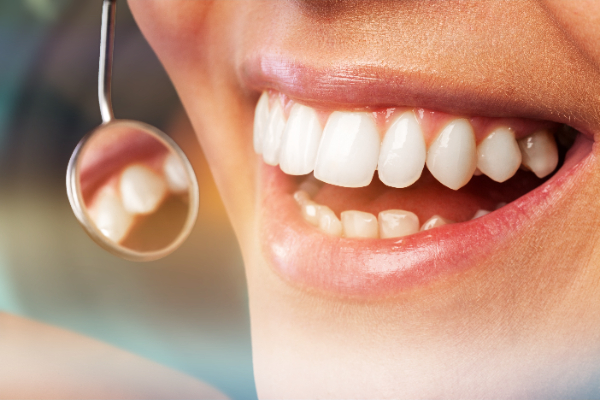 How Often Should You Get A Deep Teeth Cleaning?