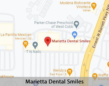 Map image for Dental Office in Marietta, GA
