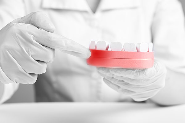 How Is Gum Disease Treated By A General Dentist?