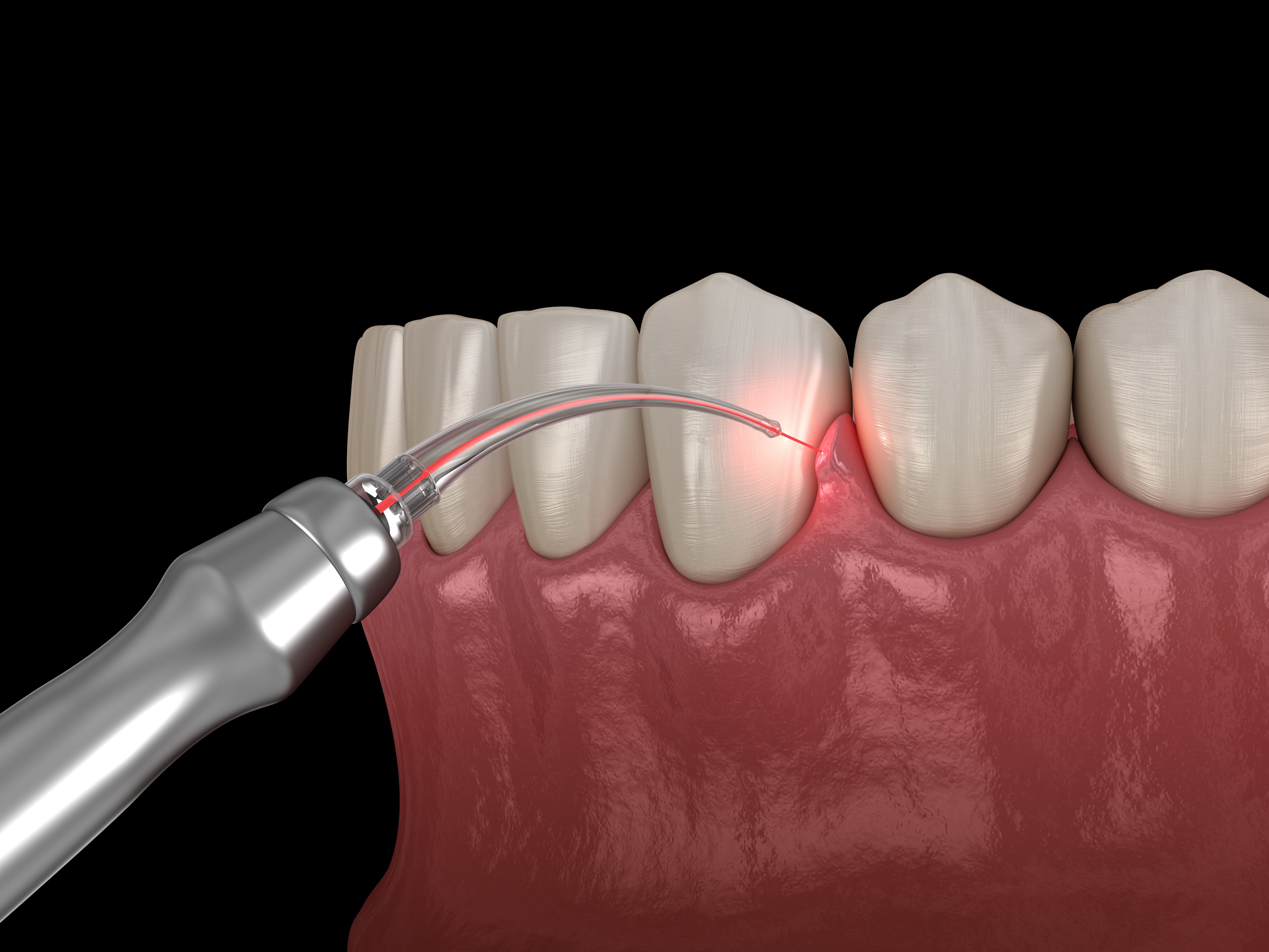 Preventive Dentistry Tips For Gum Disease