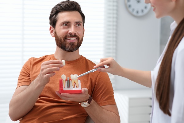 Dental Crown Placement After A Root Canal